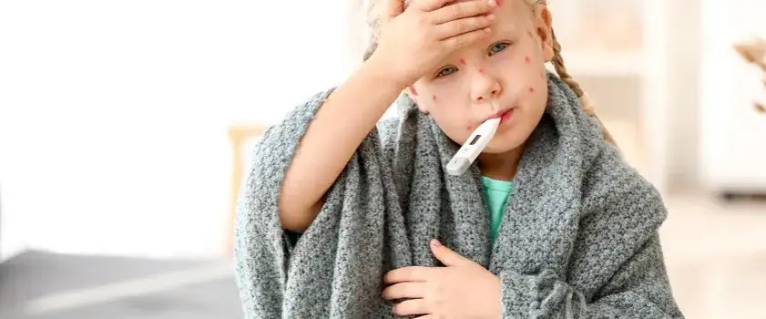 Skuteczne metody na leczenie ospy w jamie ustnej i łagodzenie bólu