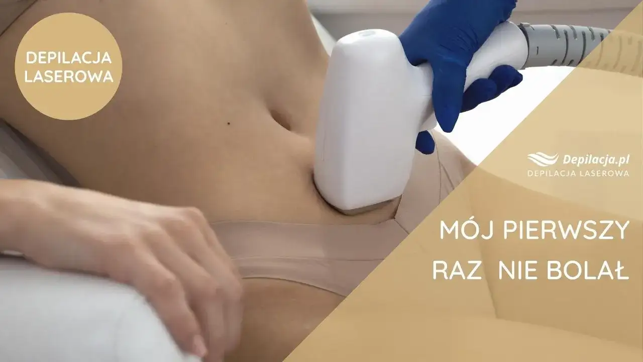 Epilacja laserowa: Co to jest i czy to rozwiązanie dla Ciebie?
