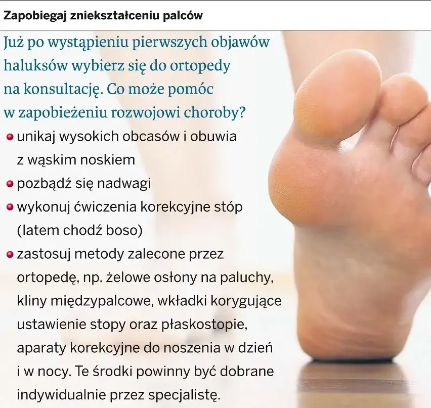 Jak wyleczyć haluksy? Pełny przewodnik: metody, koszty, rekonwalescencja