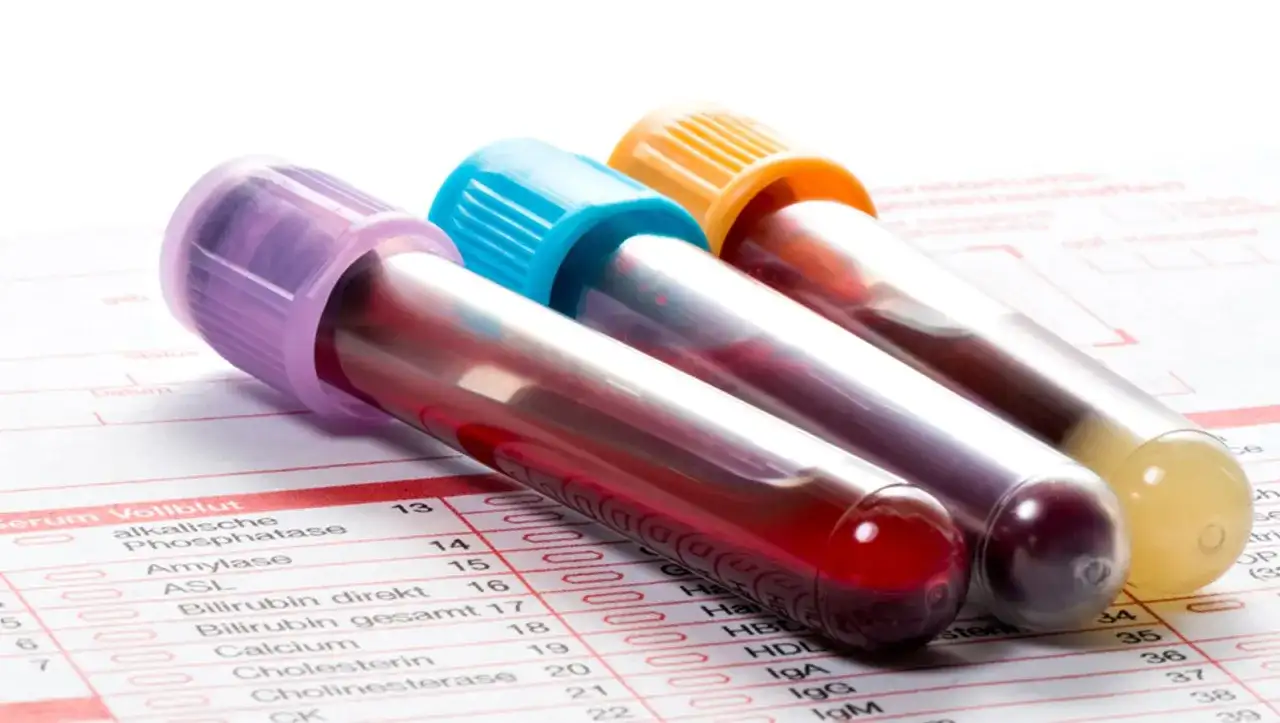 Jak długo są ważne badania morfologii? Sprawdź, zanim będzie za późno