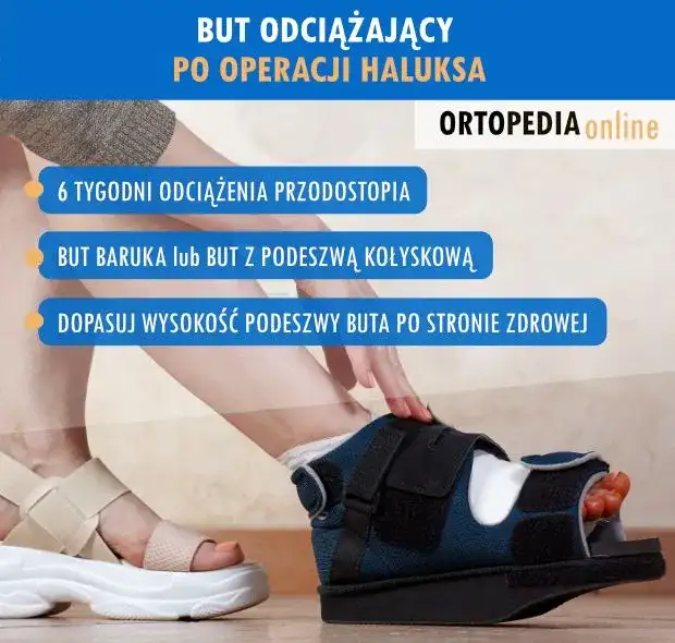 Po operacji haluksa: Jakie buty wybrać, by stopa szybko wróciła do zdrowia?