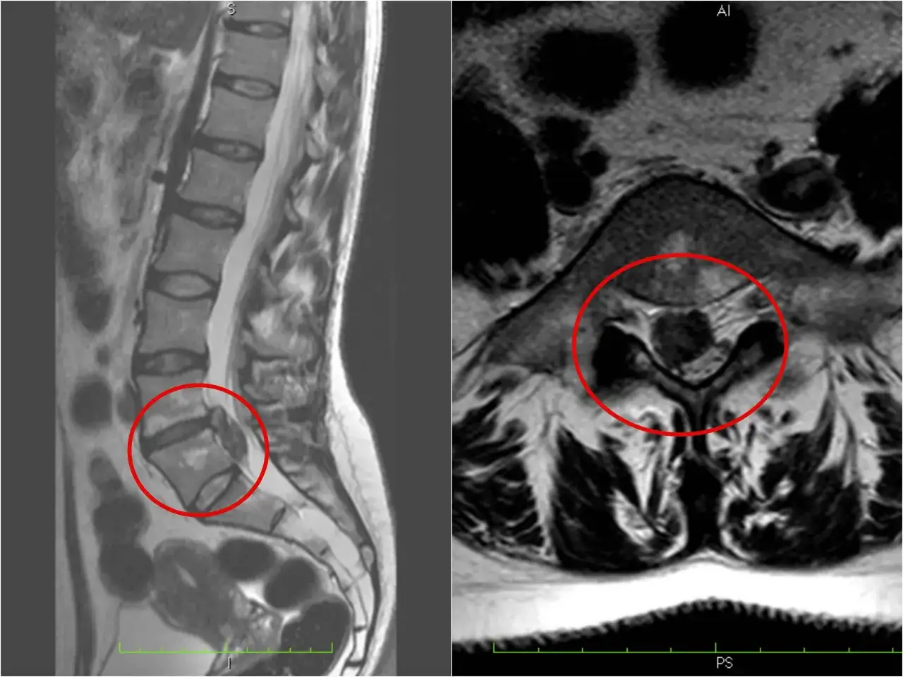Wypuklina a przepuklina: kluczowe różnice i metody leczenia