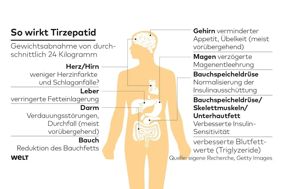 Neues Medikament für Diabetiker zum Abnehmen: Tirzepatid erklärt