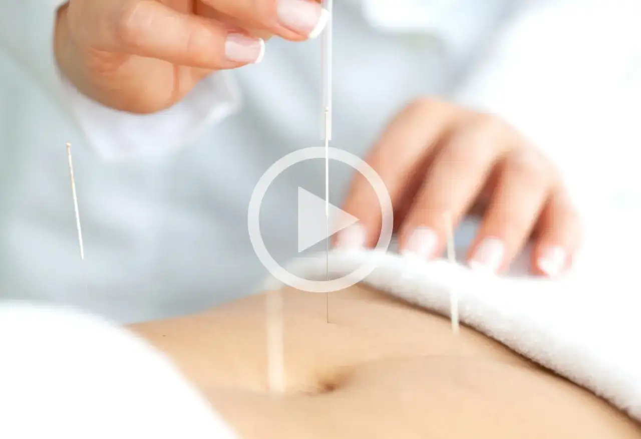 Akupunktura na płodność: Jak zwiększyć szanse na ciążę?