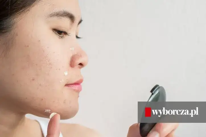 Pasta do zębów na pryszcze: Mit, który szkodzi. Co działa naprawdę?