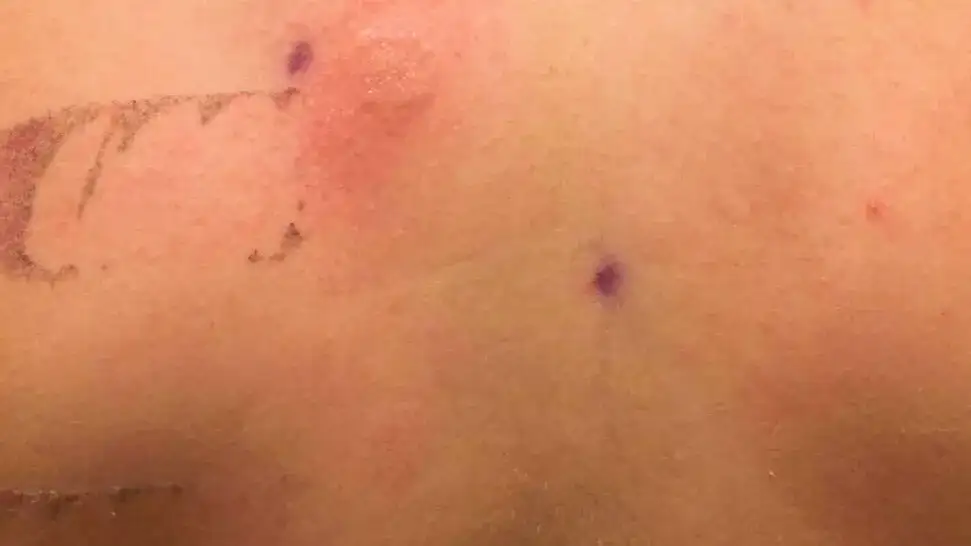 Jak rozpoznać nikiel w kosmetykach i uniknąć alergii – oznaczenia INCI