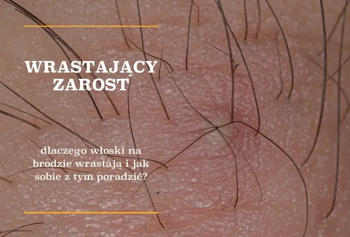 Kiedy rośnie zarost? Wiek, etapy i indywidualny rozwój