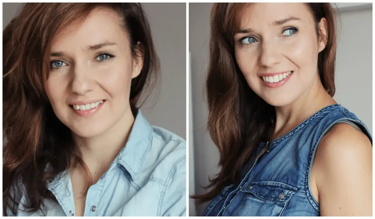 Założenie aparatu stałego: Ile trwa i czy boli? Pełny przewodnik