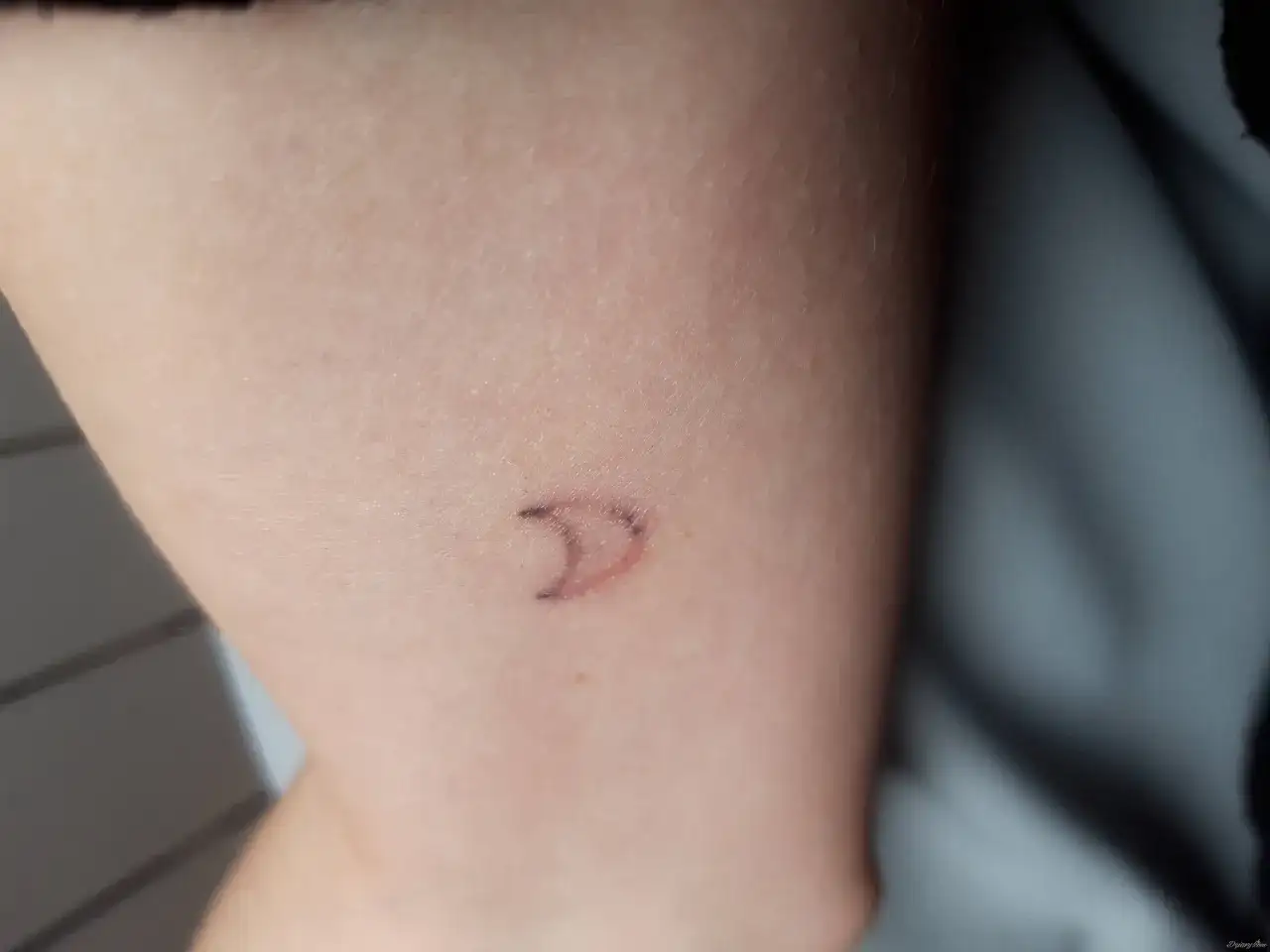 Wypadanie tuszu z tatuażu: Kiedy to norma, a kiedy problem?