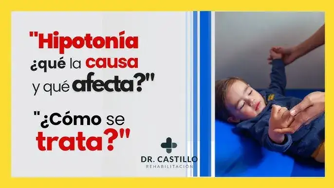 Entendiendo la hipotonía muscular: causas, síntomas y tratamientos esenciales