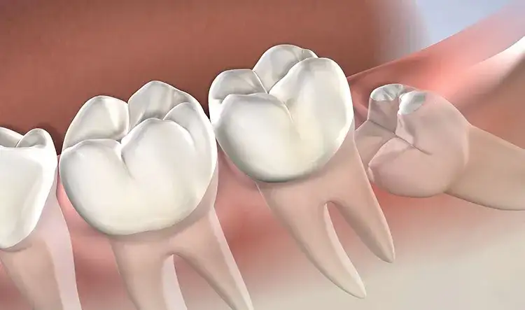 Medicamentos que se recetan después de una extracción dental y sus efectos