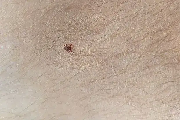 Kleszcz czy pieprzyk? Sprawdź, zanim spanikujesz! Ekspert radzi