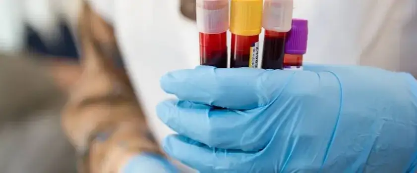 APTT: Co oznacza Twój wynik? Interpretacja i przygotowanie