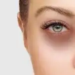 Jak zlikwidować cienie pod oczami? 8 skutecznych trików makijażowych