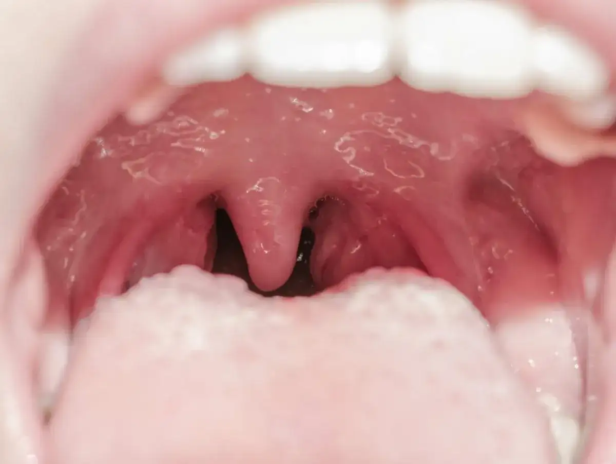 Czy migdały są zdrowe? 5 niesamowitych korzyści dla Twojego organizmu