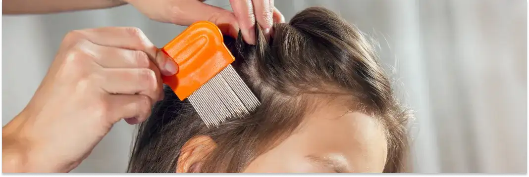 Skuteczne sposoby na zapobieganie wszawicy u dzieci - uniknij problemu!