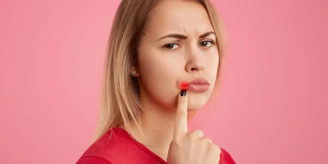 Jak zapobiec opryszczce? Najlepsze metody na uniknięcie zakażenia