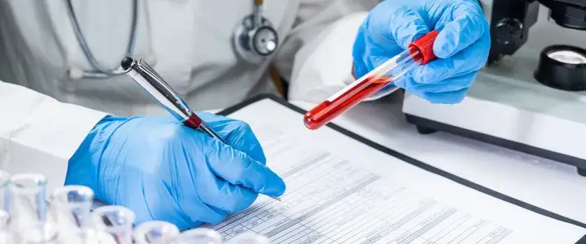 Ile kosztuje badanie IgE? Sprawdź ceny i lokalizacje w Polsce