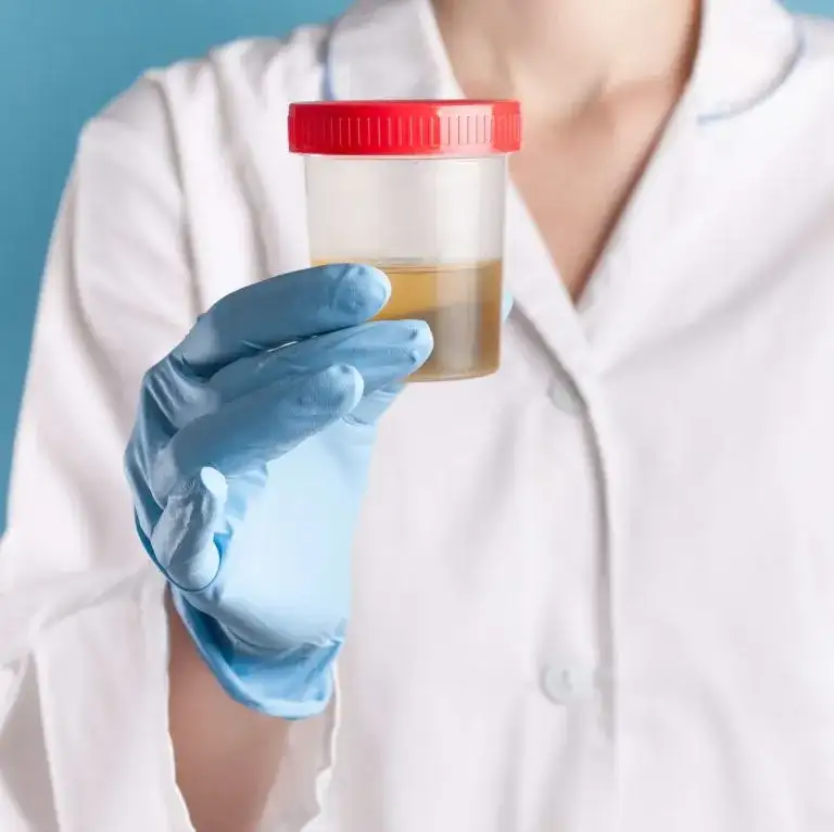 Czego nie jeść przed badaniem moczu, aby uniknąć błędnych wyników