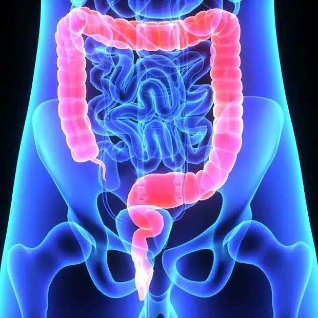 Zawał jelita objawy: poznaj niebezpieczne sygnały, które mogą uratować życie