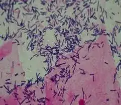 Lactobacillus spp liczne w pochwie: Dobry czy zły wynik testu?