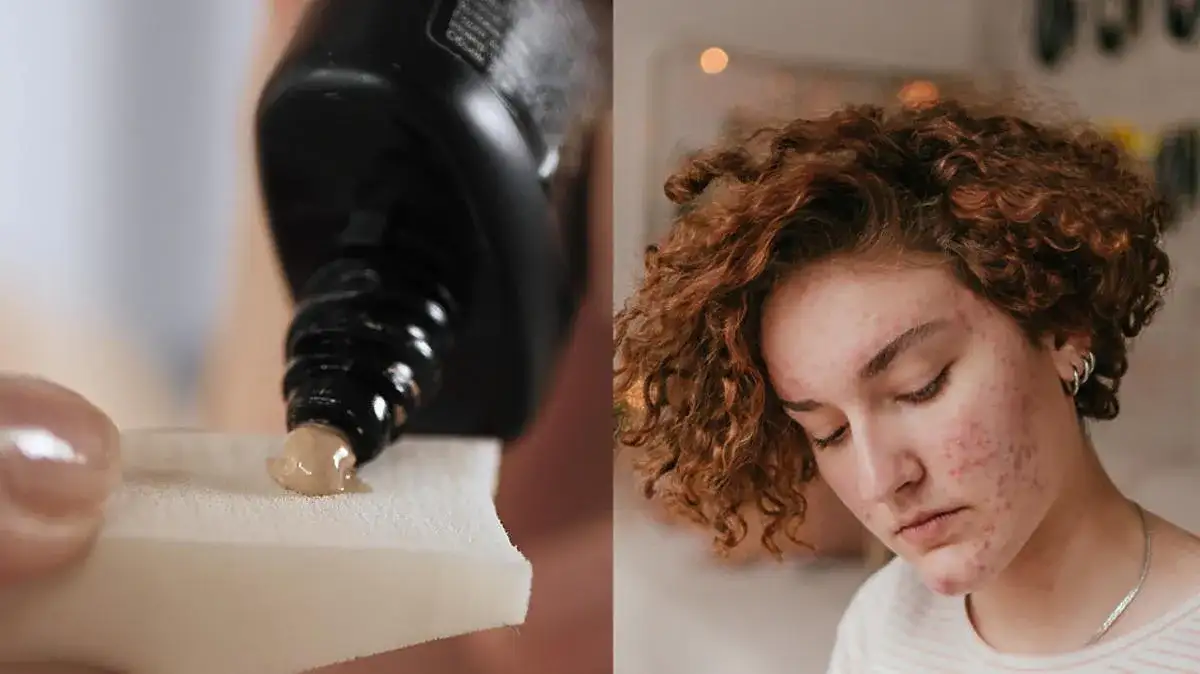 Jaki krem BB do cery trądzikowej, który naprawdę działa na skórę?