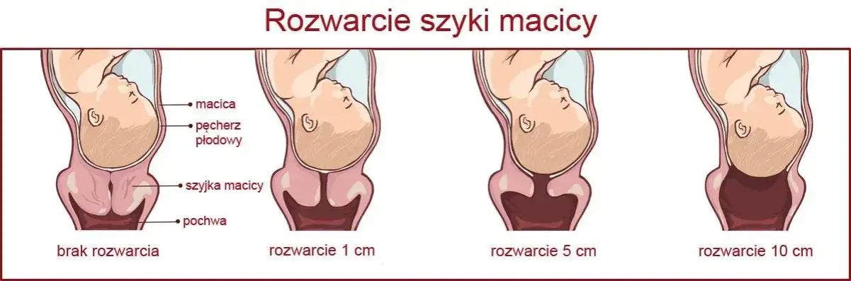 Rozwarcie na 2 palce: ile cm to jest i co oznacza w porodzie?