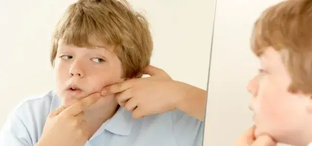 Limpieza facial niños 11 años: Cuida su piel y evita el acné