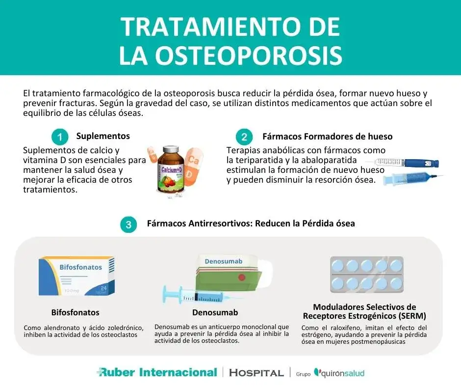 Medicamentos para la osteoporosis: opciones efectivas y riesgos a considerar