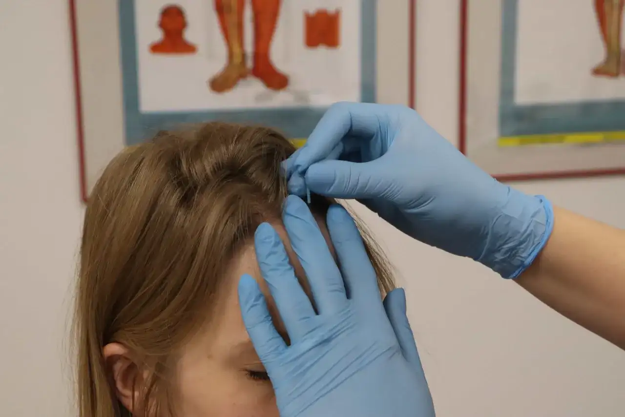 Akupunktura Tychy: Cennik 2026 i jak obniżyć koszty?