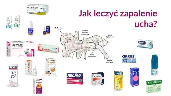 Jakie leki na zapalenie ucha u dziecka pomogą złagodzić ból?