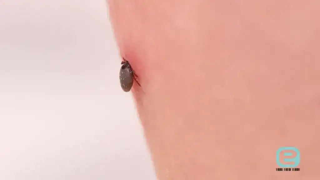 Jak rozpoznać kleszcza? Wygląd, stadia i ugryzienie