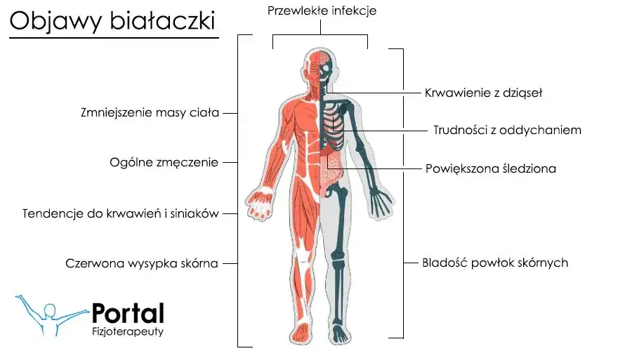 Najważniejsze objawy białaczki: lista symptomów, które powinny niepokoić