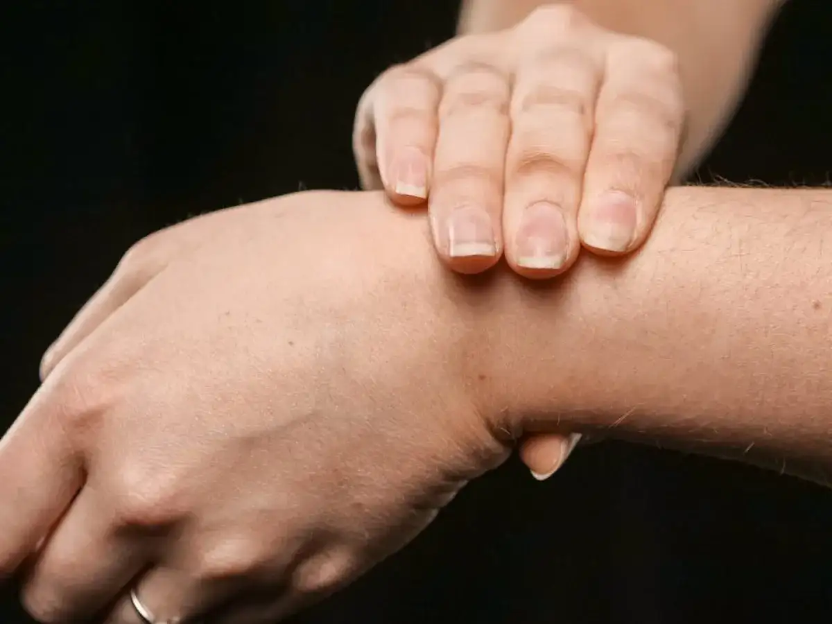 Dłoń z widocznym twardym guzem na wewnętrznej stronie nadgarstka.