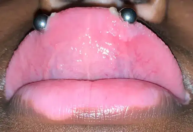 Snake eye piercing co to - wszystko, co musisz wiedzieć przed decyzją