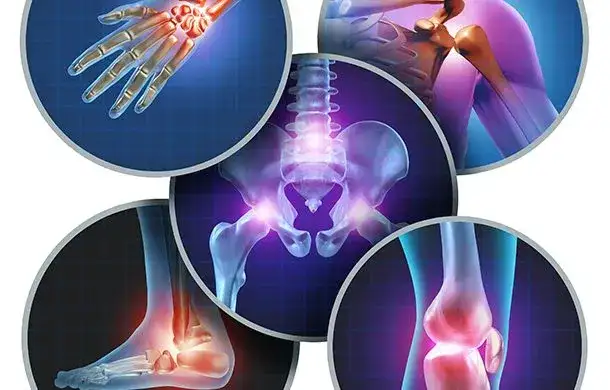 Por qué me duele los músculos: causas, síntomas y soluciones efectivas