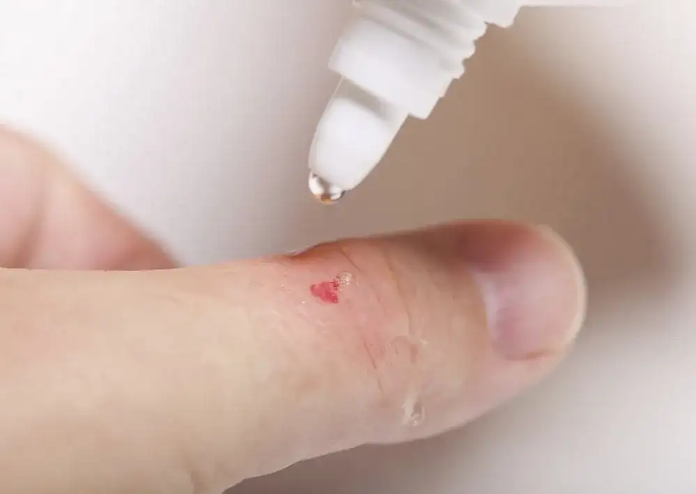 Czy woda utleniona szkodzi ranom? Zaktualizuj apteczkę!