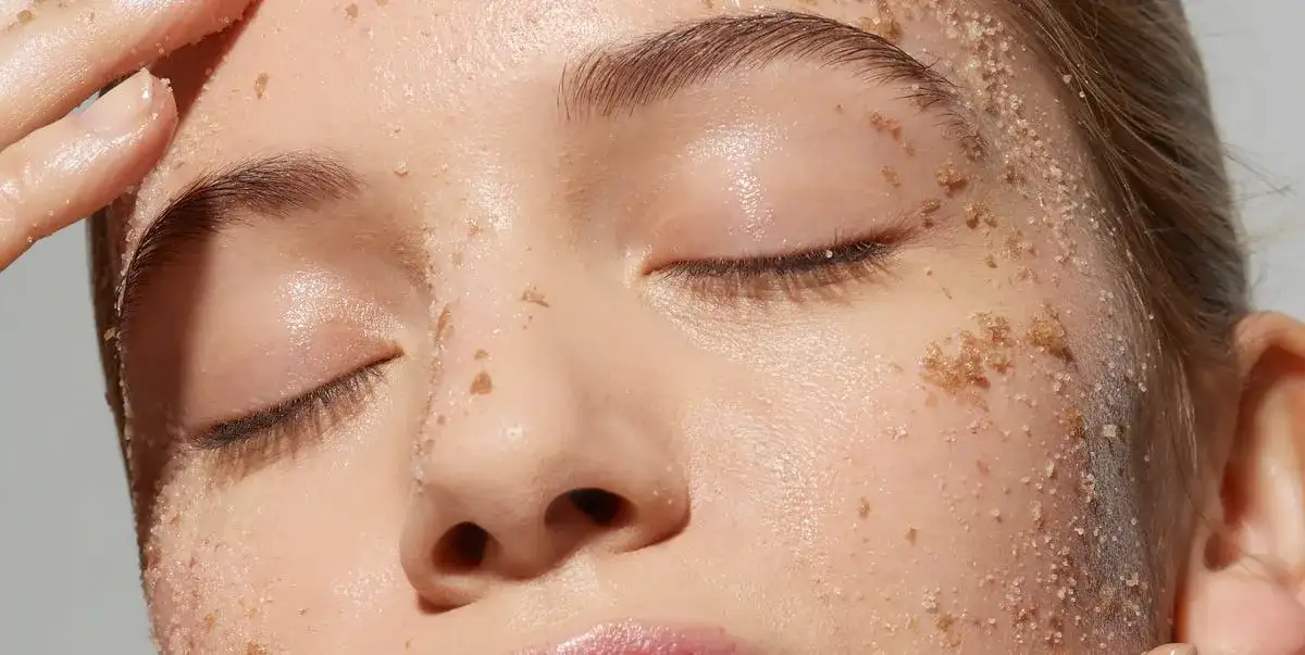 Cómo el acné cosmético puede arruinar tu piel y cómo evitarlo