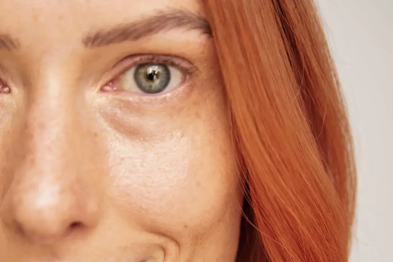 Podkrążone oczy: najczęstsze przyczyny i jak ich unikać