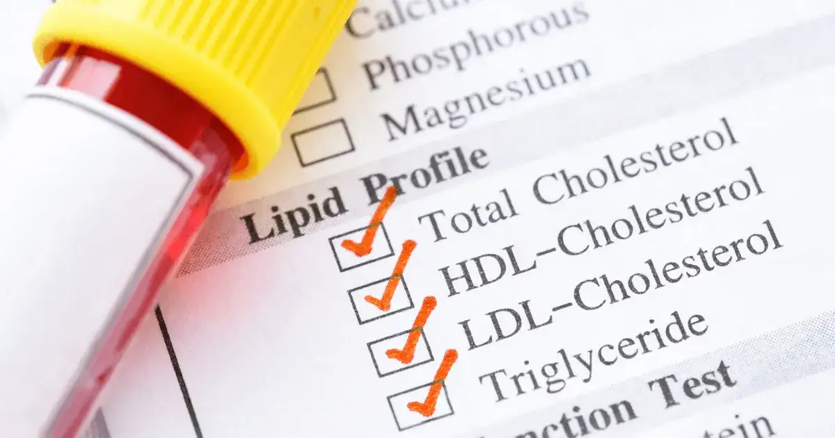 Jak się przygotować do badania cholesterolu, by uniknąć błędów?