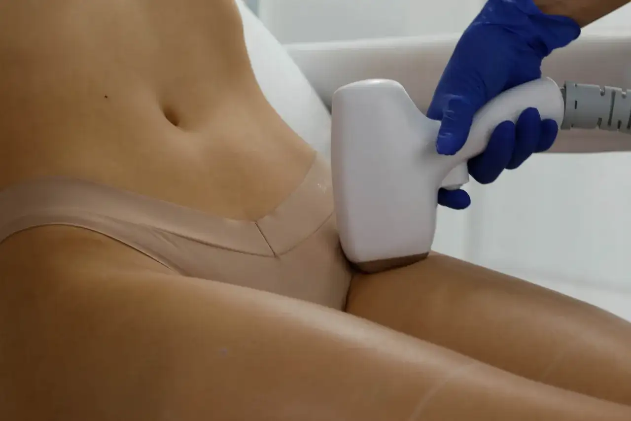 Depilacja laserowa bikini: 6-8 zabiegów? Poznaj realne liczby!