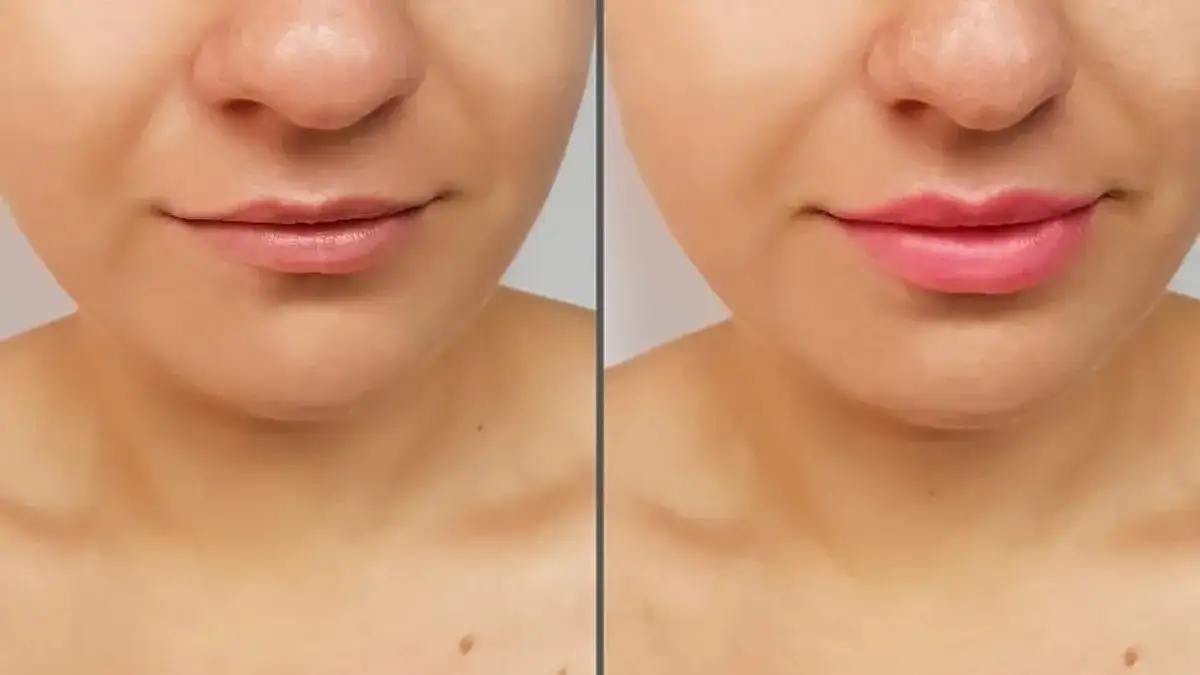 Czy błyszczyk powiększający usta działa? Oto prawda o efektach