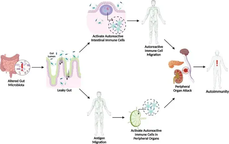 Protokół autoimmunologiczny: jego wpływ na zdrowie jelit.