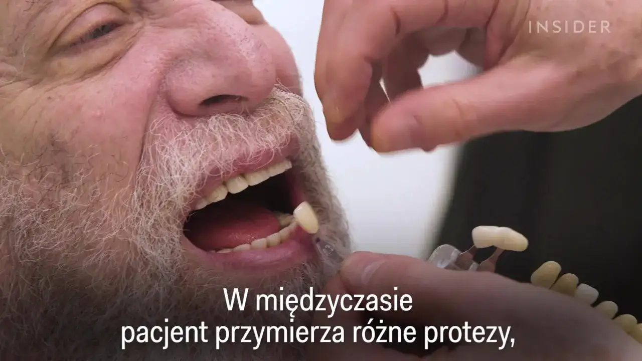 Czy dziąsła odrastają? Ekspert obala mity. Leczenie i profilaktyka