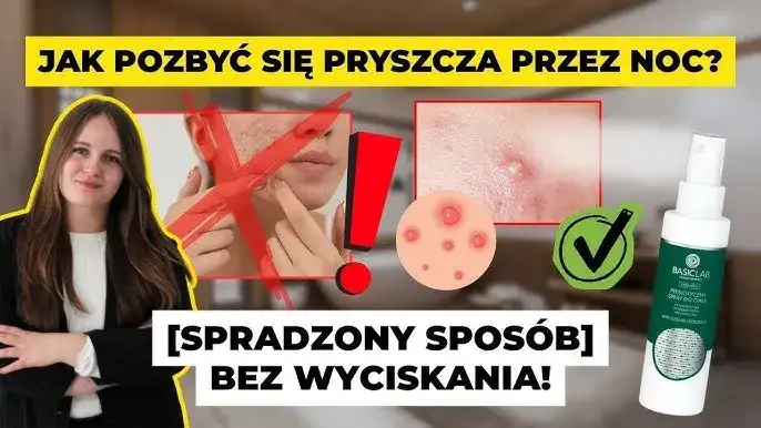 Szybko pozbądź się pryszcza sprawdzone metody na jedną noc!
