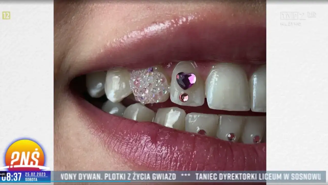 Kryształki na zęby: Ile kosztują i czy są bezpieczne? Sprawdź!