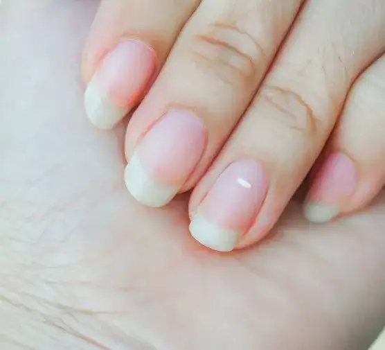 Czy olejek rycynowy jest dobry na paznokcie? Odkryj jego mocne efekty