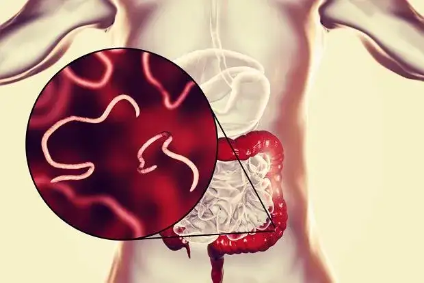 Jakie leki na robaki u dzieci: skuteczne metody leczenia pasożytów