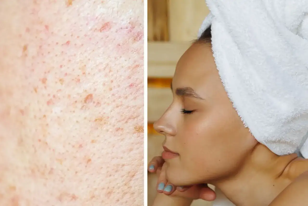 Tołpa serum rozświetlające: efekty, skład, opinie i cena