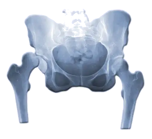 Skręcenie stawu biodrowego objawy – jak je rozpoznać i leczyć